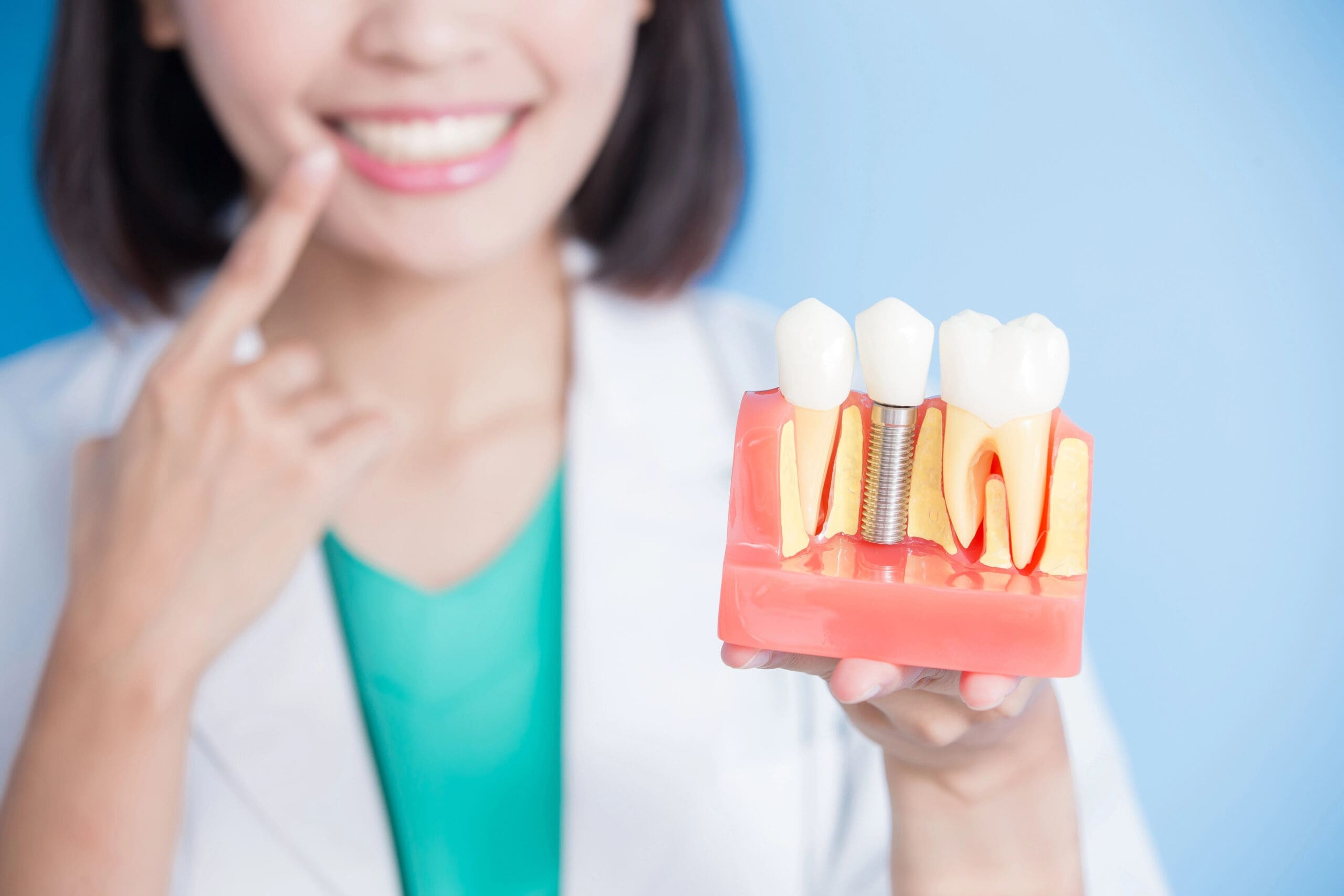 Dental Implants and Crowns: Key Differences Explained